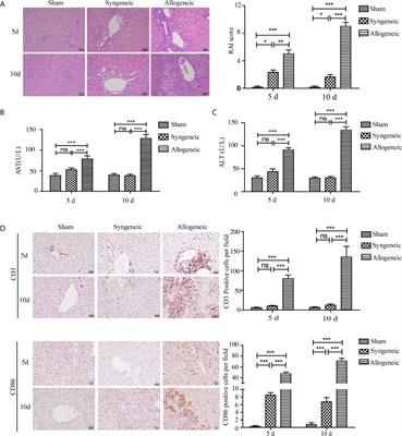 High Mobility Group Box 1 Contributes to the Acute Rejection of Liver Allografts by Activating Dendritic Cells